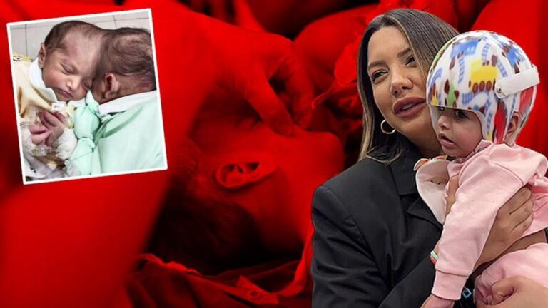 SON DAKİKA: Türkiye’de bu ameliyat ilk kez yapıldı! | ÖZEL HABER – Sağlık Haberleri