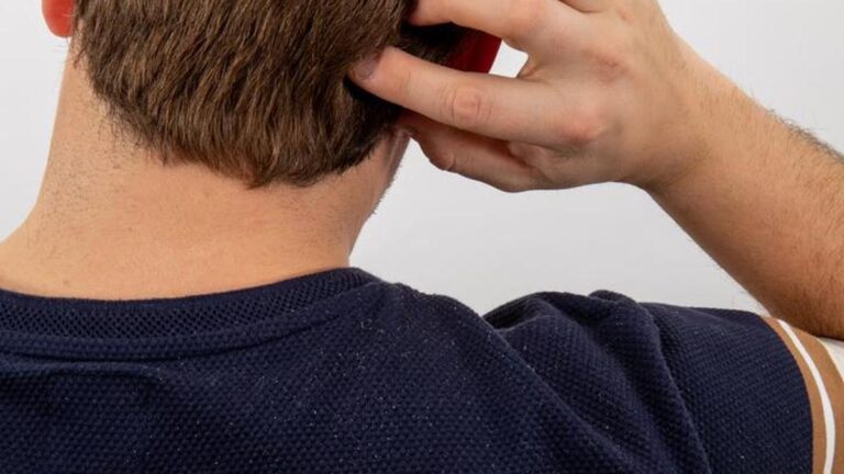 Metal aksesuar ve tekstil boyasına dikkat: Egzamanın gizli tetikleyicileri